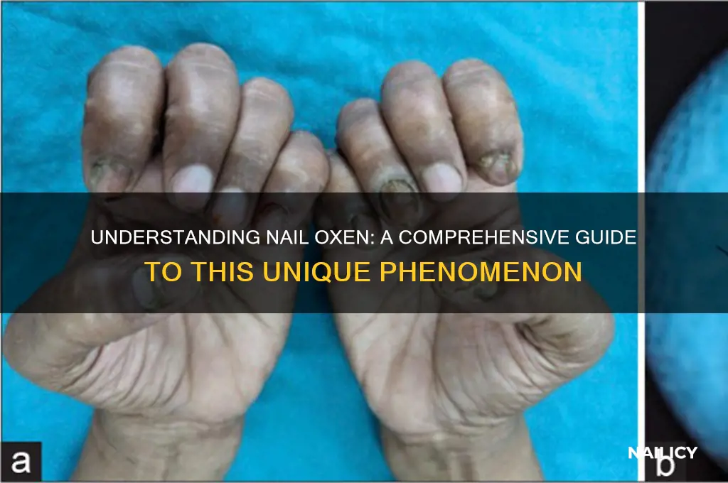 what is nail oxen