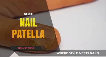 Understanding Nail Patella Syndrome: Causes, Symptoms, and Treatment Options