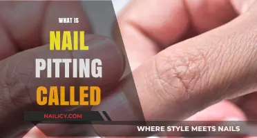 Understanding Nail Pitting: Causes, Symptoms, and Treatment Options Explained