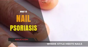 Understanding Nail Psoriasis: Causes, Symptoms, and Effective Treatment Options