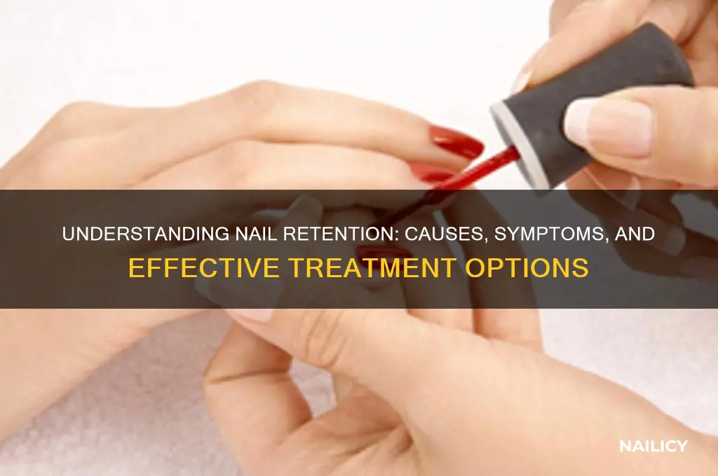 what is nail retention