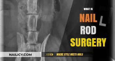 Understanding Nail Rod Surgery: Procedure, Benefits, and Recovery Explained