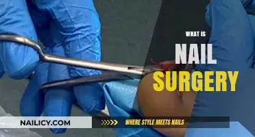 Understanding Nail Surgery: Procedures, Benefits, and Recovery Explained