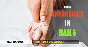 Understanding Onychauxis: Causes, Symptoms, and Treatment for Thickened Nails