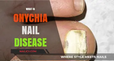 Understanding Onychia: Causes, Symptoms, and Treatment for Nail Disease