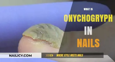 Understanding Onychogryphosis: Causes, Symptoms, and Treatment for Nail Health