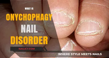 Understanding Onychophagy: Causes, Effects, and Treatment for Nail Biting Disorder