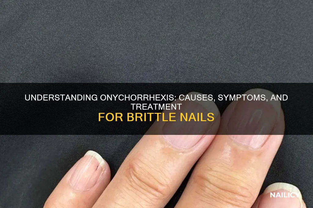 what is onychorrhexis nail disorder