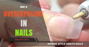 Understanding Overexposure in Nails: Causes, Effects, and Prevention Tips