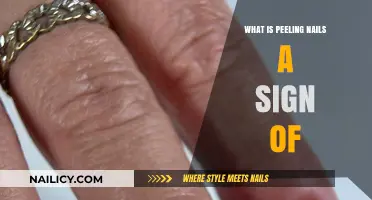 Peeling Nails: Uncovering Hidden Health Issues and Nutrient Deficiencies