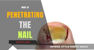 Understanding Penetrating the Nail: Causes, Risks, and Effective Treatments