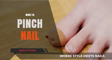 Understanding Pinch Nails: Causes, Symptoms, and Effective Treatment Options