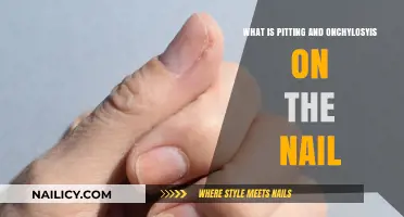 Understanding Pitting and Onycholysis: Nail Conditions Explained