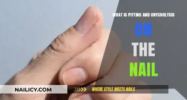 Understanding Pitting and Onycholysis: Nail Conditions Explained