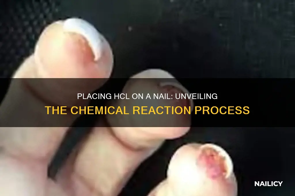 what is placing hcl with a nail like