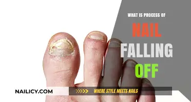 Understanding the Process of Nail Falling Off: Causes and Recovery