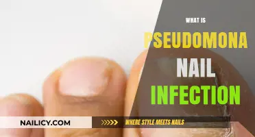 Understanding Pseudomonas Nail Infection: Causes, Symptoms, and Treatment Options