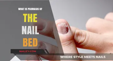 Understanding Psoriasis: Nail Bed Symptoms, Causes, and Treatment Options