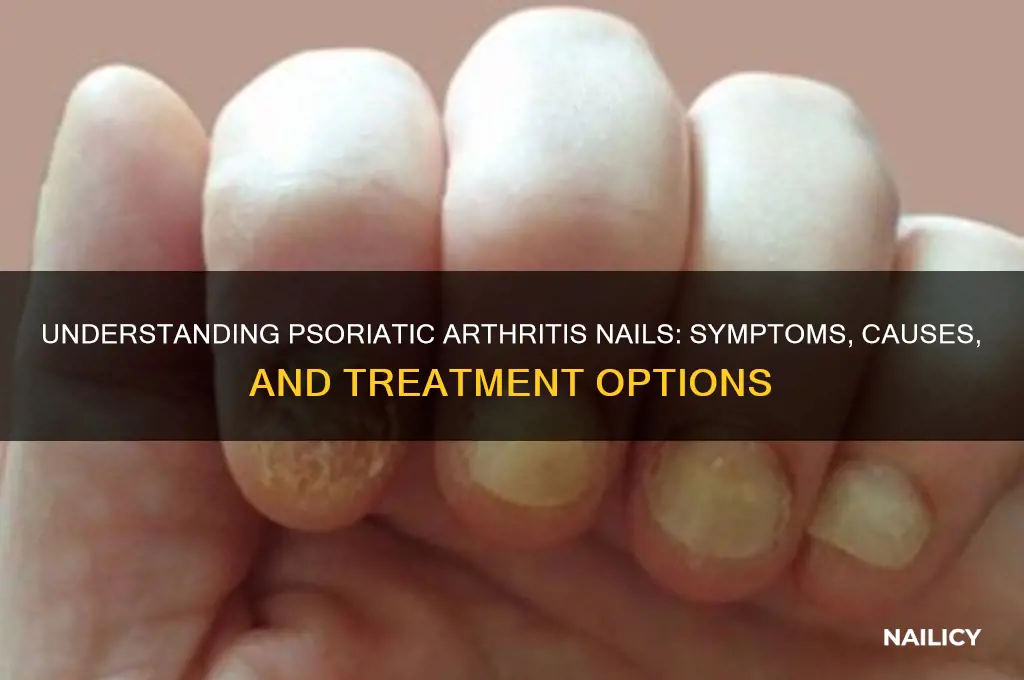 what is psoriatic arthritis nails