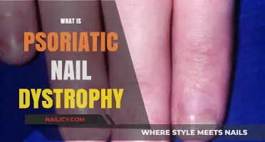 Understanding Psoriatic Nail Dystrophy: Causes, Symptoms, and Treatment Options