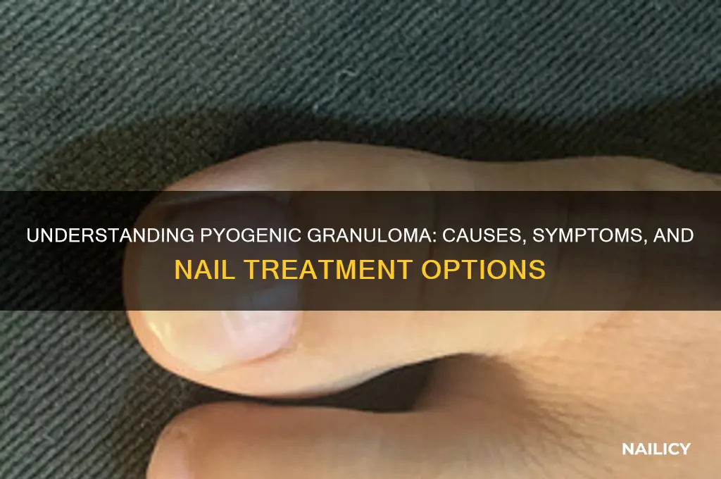 what is pyogenic granuloma nail