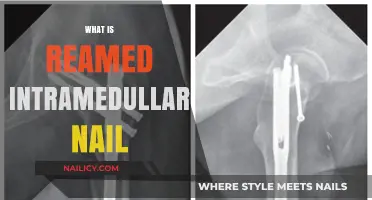 Understanding Reamed Intramedullary Nails: A Comprehensive Guide to Their Use
