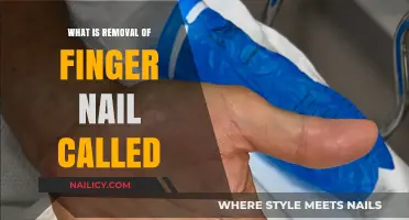 The Fingernail Removal Procedure: What's It Called?
