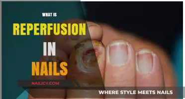 Understanding Reperfusion in Nails: Causes, Symptoms, and Treatment Options