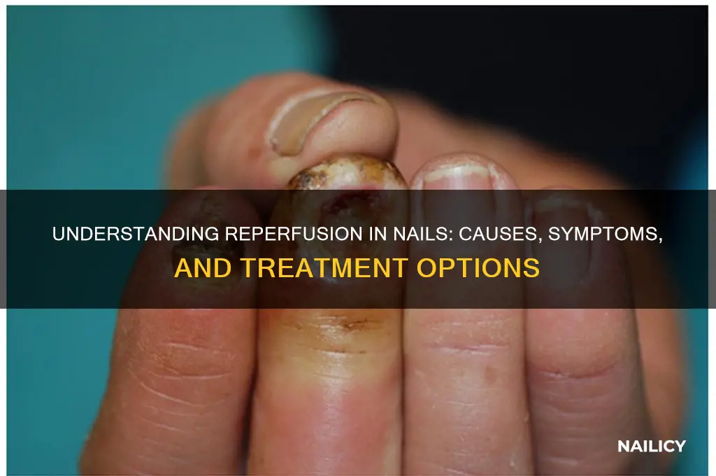 what is reperfusion in nails