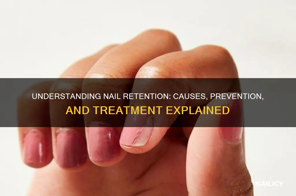 what is retention in nails