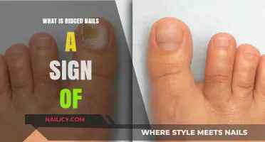 Ridged Nails: Uncovering Hidden Health Signs and Possible Causes