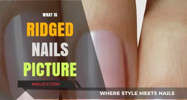 Understanding Ridged Nails: Causes, Pictures, and Treatment Options Explained