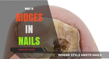 Understanding Nail Ridges: Causes, Concerns, and Care Tips