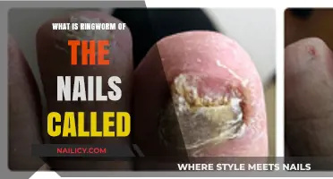 Understanding Onychomycosis: Ringworm's Impact on Nail Health Explained