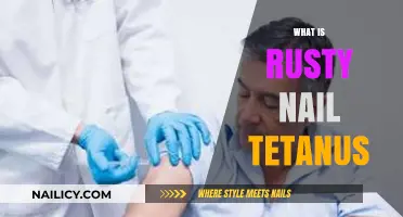 Rusty Nail Tetanus: Debunking Myths and Understanding the Real Risks