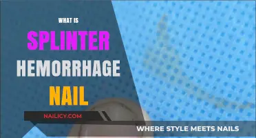 Understanding Splinter Hemorrhages: Causes, Symptoms, and Nail Health Insights
