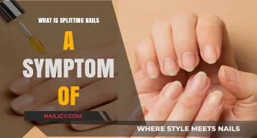 Splitting Nails: Uncovering Hidden Health Issues and Their Causes