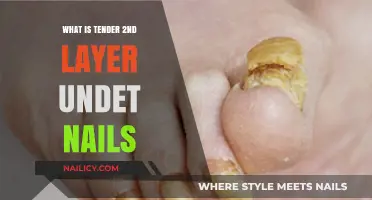 Understanding Tender 2nd Layer Under Nails: Causes, Symptoms, and Treatment