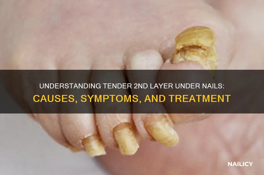 what is tender 2nd layer undet nails