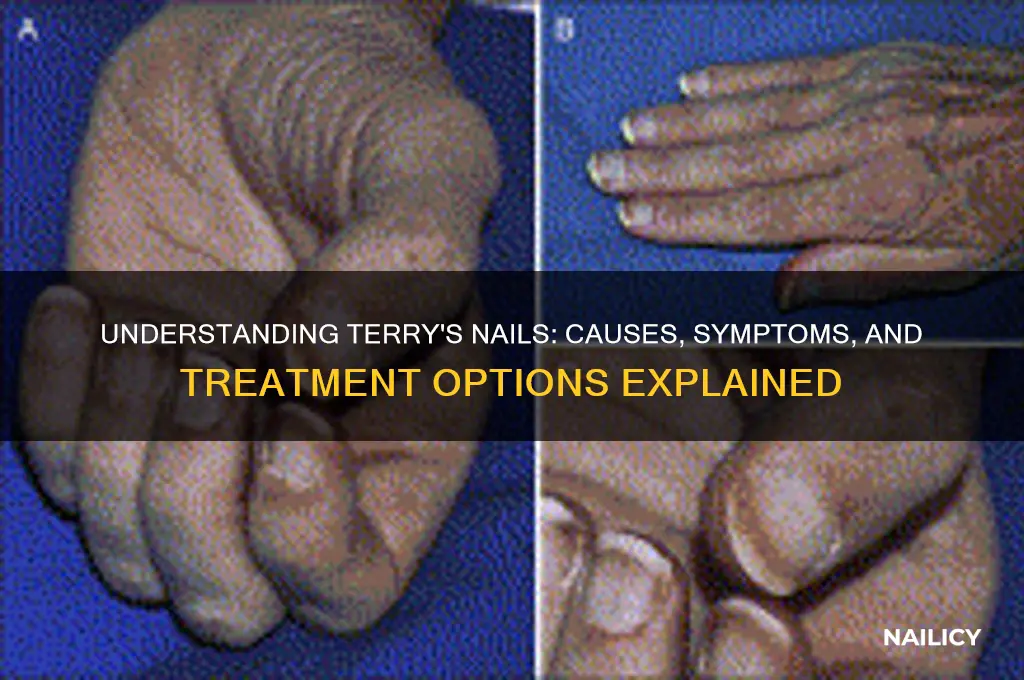 what is terry nail