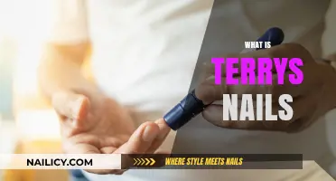 Understanding Terry's Nails: Causes, Symptoms, and Treatment Explained