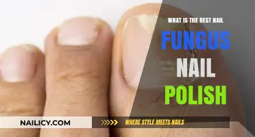 Top Nail Fungus Nail Polish: Effective Solutions for Healthy Nails