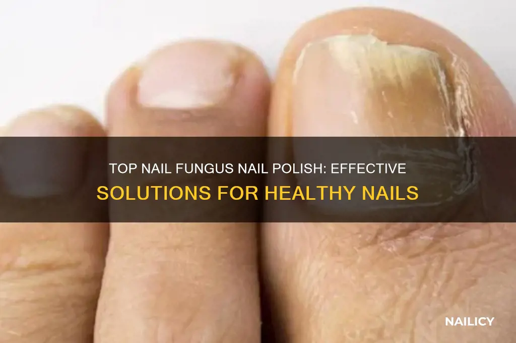 what is the best nail fungus nail polish