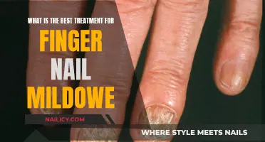 Effective Treatments for Fingernail Fungus