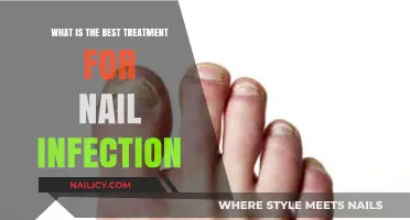 Effective Nail Infection Treatments: Top Remedies for Healthy Nails