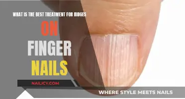 Ridge Relief: Effective Treatments for Healthy, Smooth Nails