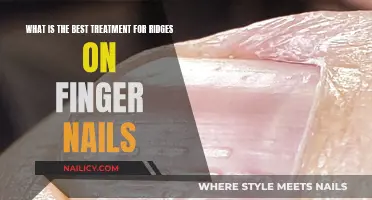 Effective Treatments for Ridges on Fingernails