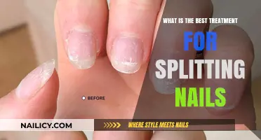 Effective Solutions for Splitting Nails: Top Treatments to Strengthen and Repair