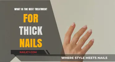 Effective Thick Nail Treatments: Top Solutions for Healthy, Strong Nails