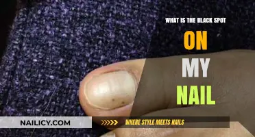 Understanding the Black Spot on Your Nail: Causes and Concerns
